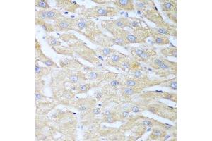 Immunohistochemistry of paraffin-embedded human liver using NUDT15 antibody. (NUDT15 anticorps  (AA 1-164))