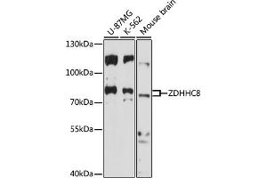 Western blot analysis of extracts of various cell lines, using ZDHHC8 antibody (ABIN7271556) at 1:1000 dilution. (ZDHHC8 anticorps  (AA 240-380))