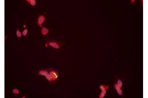 ABIN6276704 staining HeLa cells by ICC/IF. (PRMT5 anticorps  (Internal Region))