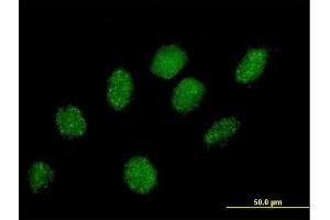 Immunofluorescence of purified MaxPab antibody to PRPF40A on HeLa cell. (PRPF40A anticorps  (AA 1-215))