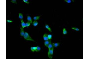 Immunofluorescence staining of SH-SY5Y cells with ABIN7172718 at 1:66, counter-stained with DAPI.