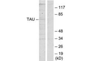 Western blot analysis of extracts from HeLa cells, using Tau (Ab-262) Antibody. (tau anticorps  (AA 551-600))