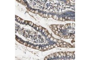 Immunohistochemical staining of human small intestine with SCN4B polyclonal antibody  shows moderate positivity in glandular cells. (SCN4B anticorps)