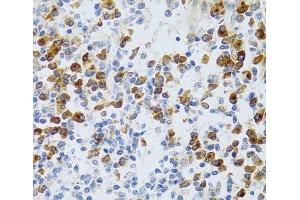 Immunohistochemistry of paraffin-embedded Human tonsil using CHAF1B Polyclonal Antibody at dilution of 1:100 (40x lens). (CHAF1B anticorps)