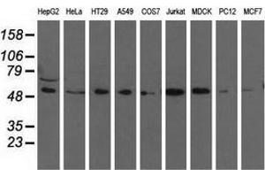 Western blot analysis of extracts (35 µg) from 9 different cell lines by using anti-TCP11L2 monoclonal antibody. (TCP11L2 anticorps)