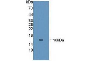 Detection of Recombinant CYP11A1, Human using Polyclonal Antibody to Cytochrome P450 11A1 (CYP11A1)