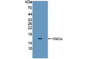 Detection of Recombinant CYP11A1, Human using Polyclonal Antibody to Cytochrome P450 11A1 (CYP11A1) (CYP11A1 anticorps  (AA 392-521))