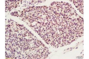 Formalin-fixed and paraffin embedded mouse embryo labeled with Rabbit Anti-FBXO11 Polyclonal Antibody, Unconjugated  at 1:200 followed by conjugation to the secondary antibody and DAB staining