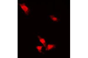 Immunofluorescent analysis of AKT (pS473) staining in MCF7 cells. (AKT1 anticorps  (C-Term, pSer473))