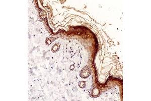 Immunohistochemistry of paraffin embedded rat skin using NCK (ABIN7074783) at dilution of 1:2000 (200x lens) (NCK2 anticorps)