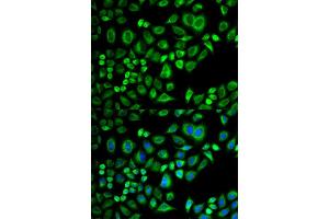 Immunofluorescence (IF) image for anti-Apolipoprotein D (APOD) antibody (ABIN1876485) (Apolipoprotein D anticorps)
