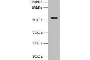 Western blot All lanes: DENND2D antibody at 4 μg/mL + MCF-7 whole cell lysate Secondary Goat polyclonal to rabbit IgG at 1/10000 dilution Predicted band size: 54 kDa Observed band size: 54 kDa