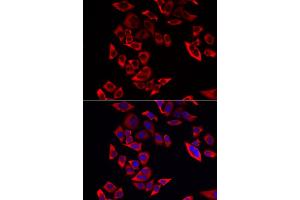 Immunofluorescence analysis of MCF-7 cells using RPL9 antibody.