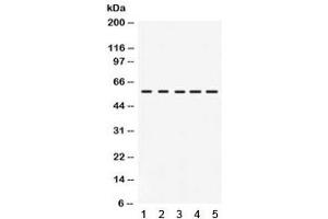 Western blot testing of 1) rat intestine, 2) human HeLa, 3) human COLO320, 4) mouse NIH3T3 and 5) mouse HEPA lysate with IRF5 antibody. (IRF5 anticorps)