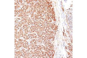 Immunohistochemistry of paraffin-embedded rat ovary using KCNS3 antibody (ABIN6132153, ABIN6142774, ABIN6142775 and ABIN6223897) at dilution of 1:100 (40x lens). (KCNS3 anticorps  (AA 1-180))