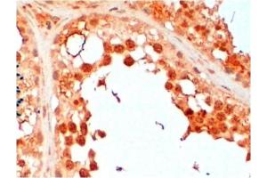 Paraffin Embedded Human Testis stained with UBE2R2 antibody at 2 μg/ml. (UBE2R2 anticorps  (N-Term))