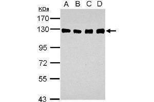 WB Image Sample (30 ug of whole cell lysate) A: A549 B: H1299 C: HCT116 D: MCF-7 7.