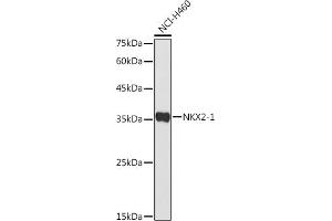 Western blot analysis of extracts of NCI-H460 cells, using NKX2-1 antibody (ABIN3017367, ABIN3017368, ABIN1681058 and ABIN6220056) at 1:500 dilution. (NKX2-1 anticorps)