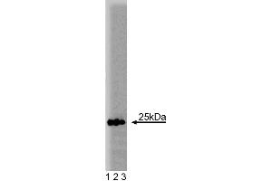 Western blot analysis of Rab5 on human endothelial lysate. (RAB5 anticorps  (AA 1-215))