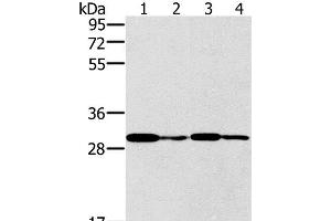 Western Blot analysis of K562 cell and Human liver cancer tissue, Jurkat and A549 cell using PNMT Polyclonal Antibody at dilution of 1:400 (PNMT anticorps)
