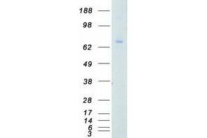 Validation with Western Blot