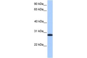 Western Blotting (WB) image for anti-Cyclin-Dependent Kinase Inhibitor 3 (CDKN3) antibody (ABIN2463585) (CDKN3 anticorps)