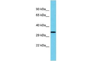 Host: Rabbit Target Name: UBFD1 Sample Type: Fetal Kidney lysates Antibody Dilution: 1. (UBFD1 anticorps  (Middle Region))