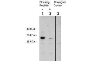 Image no. 1 for anti-Four and A Half LIM Domains 2 (FHL2) antibody (ABIN201816) (FHL2 anticorps)