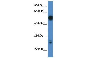 Western Blot showing Gal3st4 antibody used at a concentration of 1. (GAL3ST4 anticorps  (C-Term))