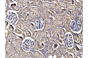 IHC analysis of Integrin Linked ILK using anti-Integrin Linked ILK antibody (ABIN7599411). (ILK anticorps  (AA 1-452))