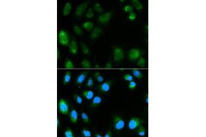 Immunofluorescence analysis of MCF7 cell using UCP3 antibody. (UCP3 anticorps  (AA 1-110))