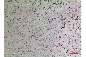 Immunohistochemistry (IHC) analysis of paraffin-embedded Mouse Brain, antibody was diluted at 1:100.
