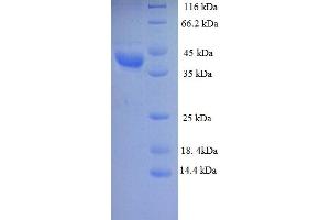 SDS-PAGE (SDS) image for Lactate Dehydrogenase D (LDHD) (AA 1-331), (full length) protein (His tag) (ABIN5713182)