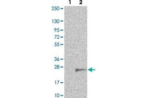 Western blot analysis of Lane 1: Negative control (vector only transfected HEK293T lysate). (TMEM97 anticorps)