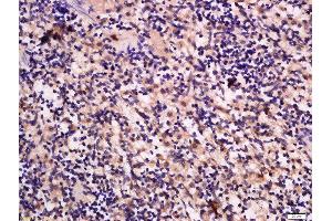 Formalin-fixed and paraffin embedded rat spleen labeled with Anti-GRB10/14 Polyclonal Antibody, Unconjugated  at 1:300 followed by conjugation to the secondary antibody and DAB staining. (GRB10/14 (AA 501-594) anticorps)