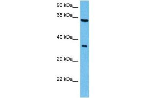 Host:  Mouse  Target Name:  SHC1  Sample Tissue:  Mouse Brain  Antibody Dilution:  1ug/ml