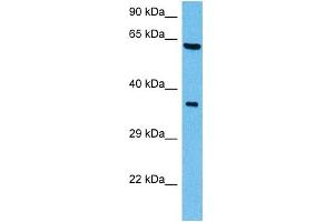 Host:  Mouse  Target Name:  SHC1  Sample Tissue:  Mouse Brain  Antibody Dilution:  1ug/ml (SHC1 anticorps  (C-Term))