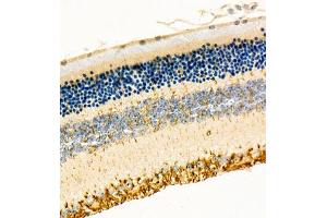 Immunohistochemistry of paraffin embedded mouse eye using Cep78 (ABIN7073432) at dilution of 1:200 (400x lens)