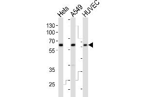 Western blot analysis of lysates from Hela, A549, HUVEC cell line (from left to right), using ESRRG Antibody (Center) (ABIN392350 and ABIN2841989). (ESRRG anticorps  (AA 189-221))