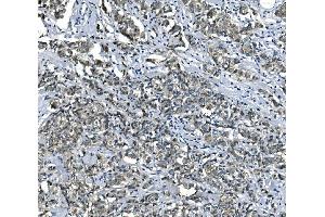 IHC analysis of eRF1/ETF1 using anti-eRF1/ETF1 antibody (ABIN7602626). (ETF1 anticorps  (AA 9-342))