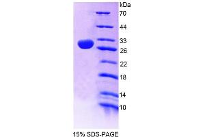 SDS-PAGE (SDS) image for 2',3'-Cyclic Nucleotide 3' phosphodiesterase (CNP) (AA 186-421) protein (His tag) (ABIN6239070)