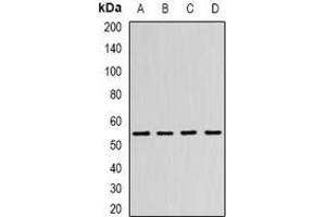 Western blot analysis of N-WASP expression in SW480 (A), MCF7 (B), mouse brain (C), mouse kidney (D) whole cell lysates. (Neural Wiskott-Aldrich syndrome protein (WASL) anticorps)