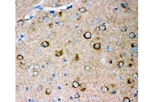 IHC-P: GLUR2 antibody testing of mouse brain tissue (GRIA2 anticorps  (AA 25-360))