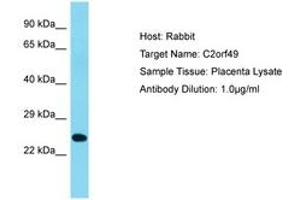Image no. 1 for anti-Chromosome 2 Open Reading Frame 49 (C2orf49) (AA 93-142) antibody (ABIN6750665) (C2orf49 anticorps  (AA 93-142))