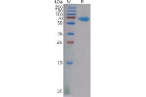 Human E Protein, hFc Tag on SDS-PAGE under reducing condition.