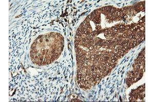 Image no. 6 for anti-Proteasome Subunit alpha 4 (PSMA4) antibody (ABIN1500458)