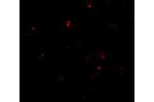 Immunofluorescence of PEN2 in K562 cells with this product at 20 μg/ml.