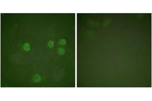 Immunofluorescence analysis of HeLa cells, using Cyclin B1 (Ab-126) Antibody.