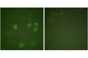 Immunofluorescence analysis of HeLa cells, using Cyclin B1 (Ab-126) Antibody.