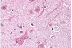 Human Brain, Cortex (formalin-fixed, paraffin-embedded) stained with SCN5A antibody ABIN290512 at 5-10 ug/ml followed by biotinylated anti-goat IgG secondary antibody ABIN481715, alkaline phosphatase-streptavidin and chromogen. (SCN5A anticorps  (AA 1548-1558))